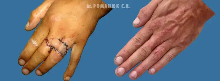 Реконструктивная хирургия в Одессе
